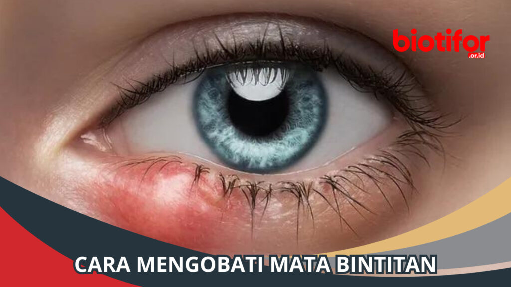 Cara Mengobati Mata Bintitan Solusi Praktis Dan Alami Biotifor