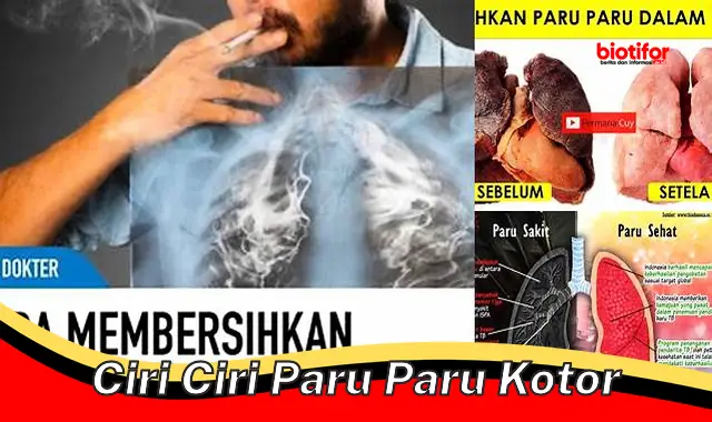 Deteksi Dini Ciri-ciri Paru Kotor: Jaga Kesehatan Paru Anda