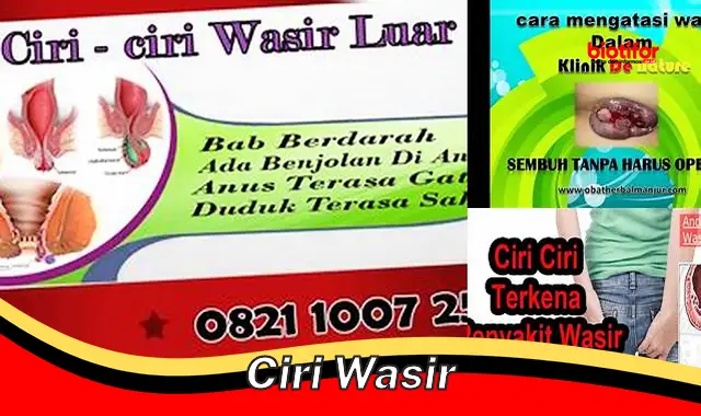 Kenali Ciri-Ciri Wasir yang Ganggu Kenyamanan Anda