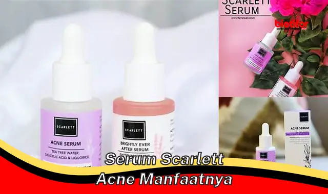 serum scarlett acne manfaatnya