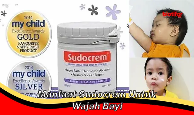 manfaat sudocrem untuk wajah bayi