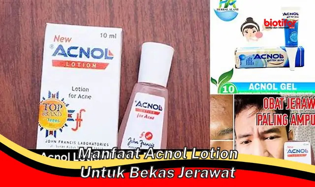 manfaat acnol lotion untuk bekas jerawat