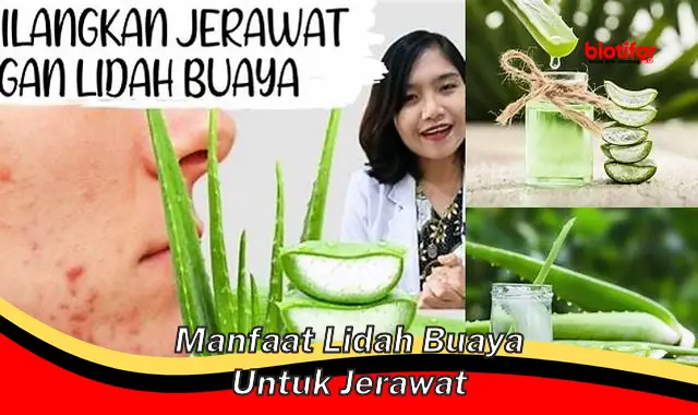 manfaat lidah buaya untuk jerawat