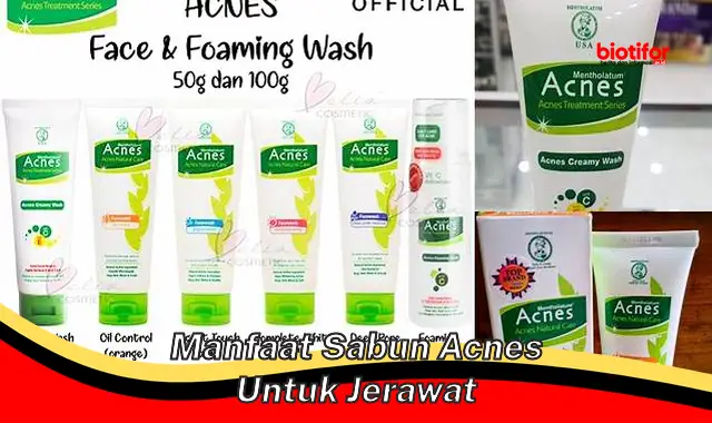 manfaat sabun acnes untuk jerawat