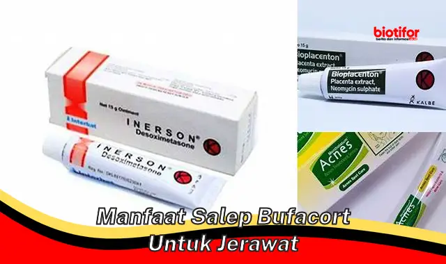 manfaat salep bufacort untuk jerawat