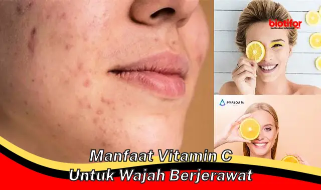 manfaat vitamin c untuk wajah berjerawat