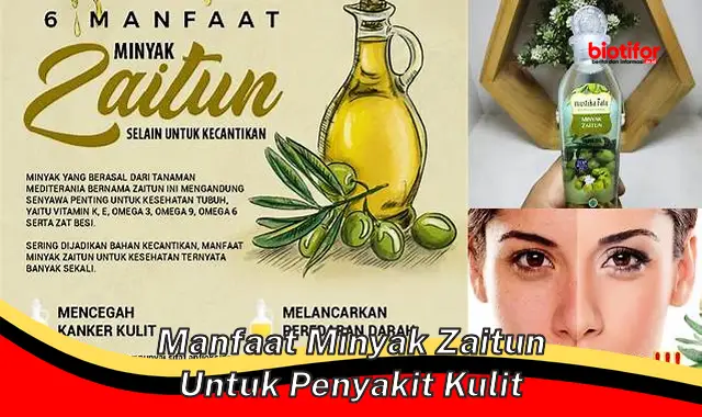 manfaat minyak zaitun untuk penyakit kulit