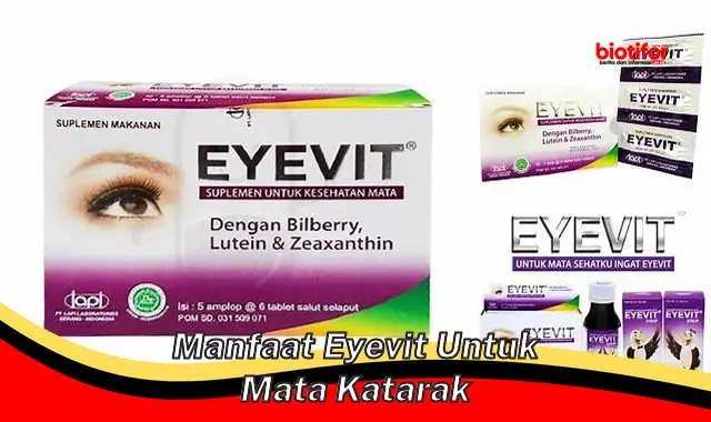manfaat eyevit untuk mata katarak
