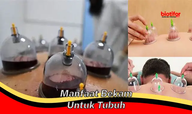 manfaat bekam untuk tubuh