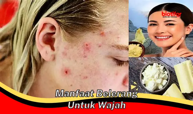 manfaat belerang untuk wajah