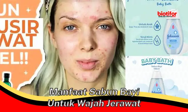 manfaat sabun bayi untuk wajah jerawat