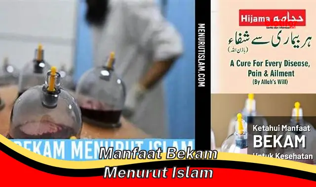 manfaat bekam menurut islam