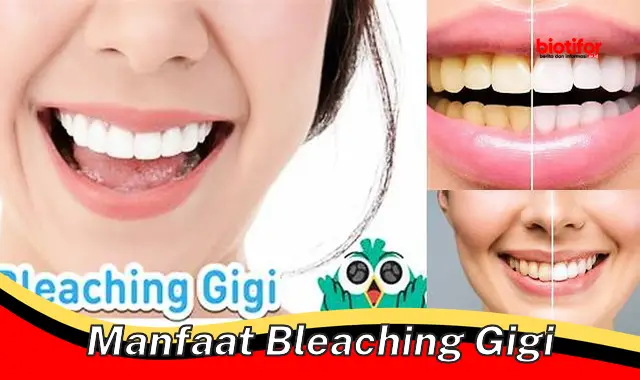 manfaat bleaching gigi