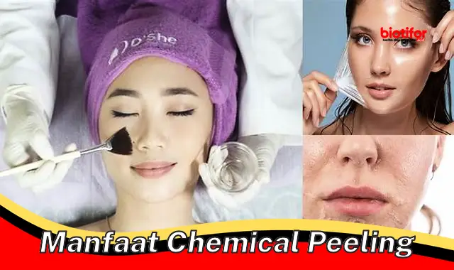 manfaat chemical peeling