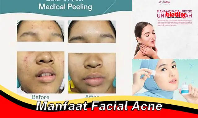 Temukan 5 Manfaat Facial Jerawat yang Jarang Diketahui