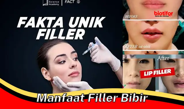 Temukan Manfaat Filler Bibir yang Jarang Diketahui