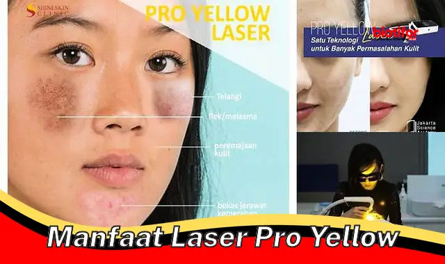 Pelajari Rahasia Manfaat Laser Pro Yellow yang Jarang Diketahui - Biotifor