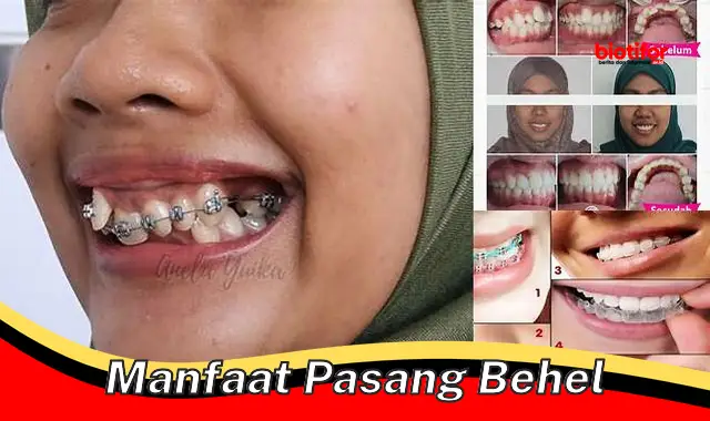 manfaat pasang behel