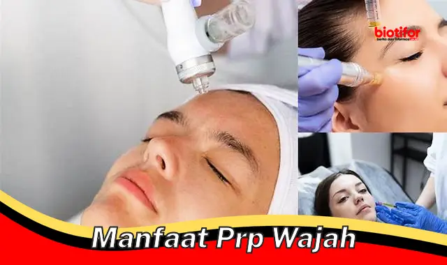 manfaat prp wajah