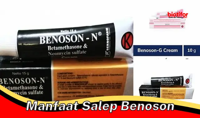 Temukan Khasiat Salep Benoson yang Jarang Diketahui