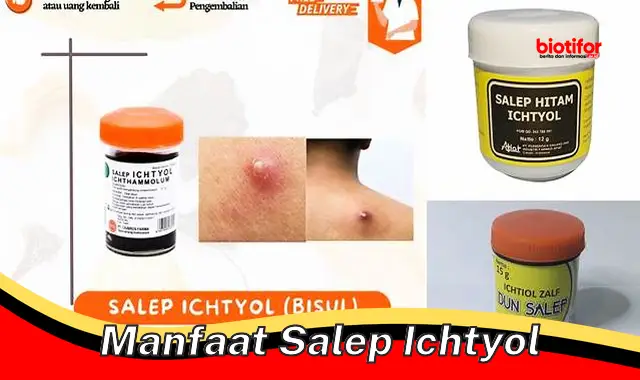 manfaat salep ichtyol