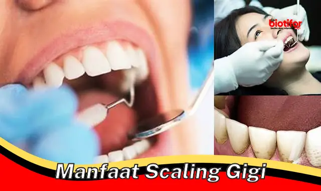 manfaat scaling gigi
