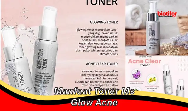 manfaat toner ms glow acne