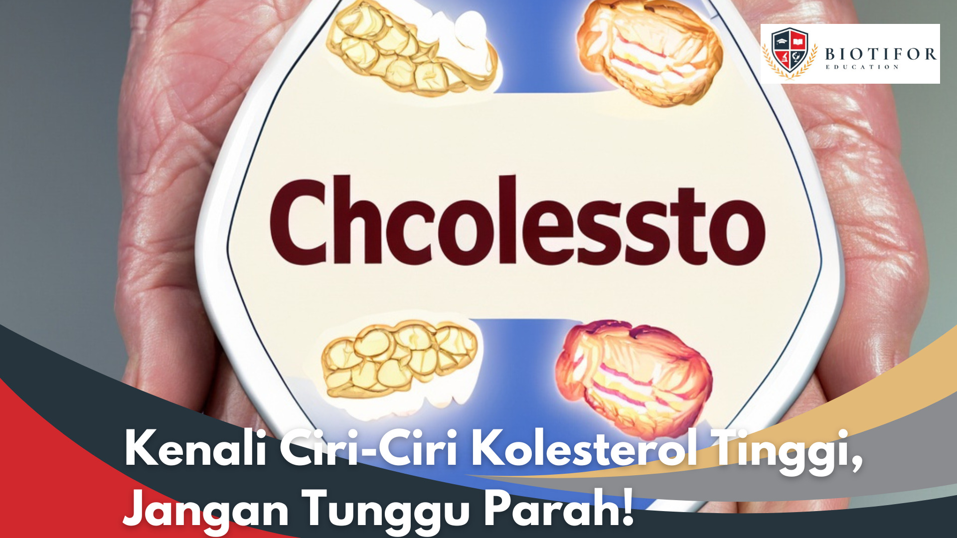 Kenali Ciri-Ciri Kolesterol Tinggi, Jangan Tunggu Parah!