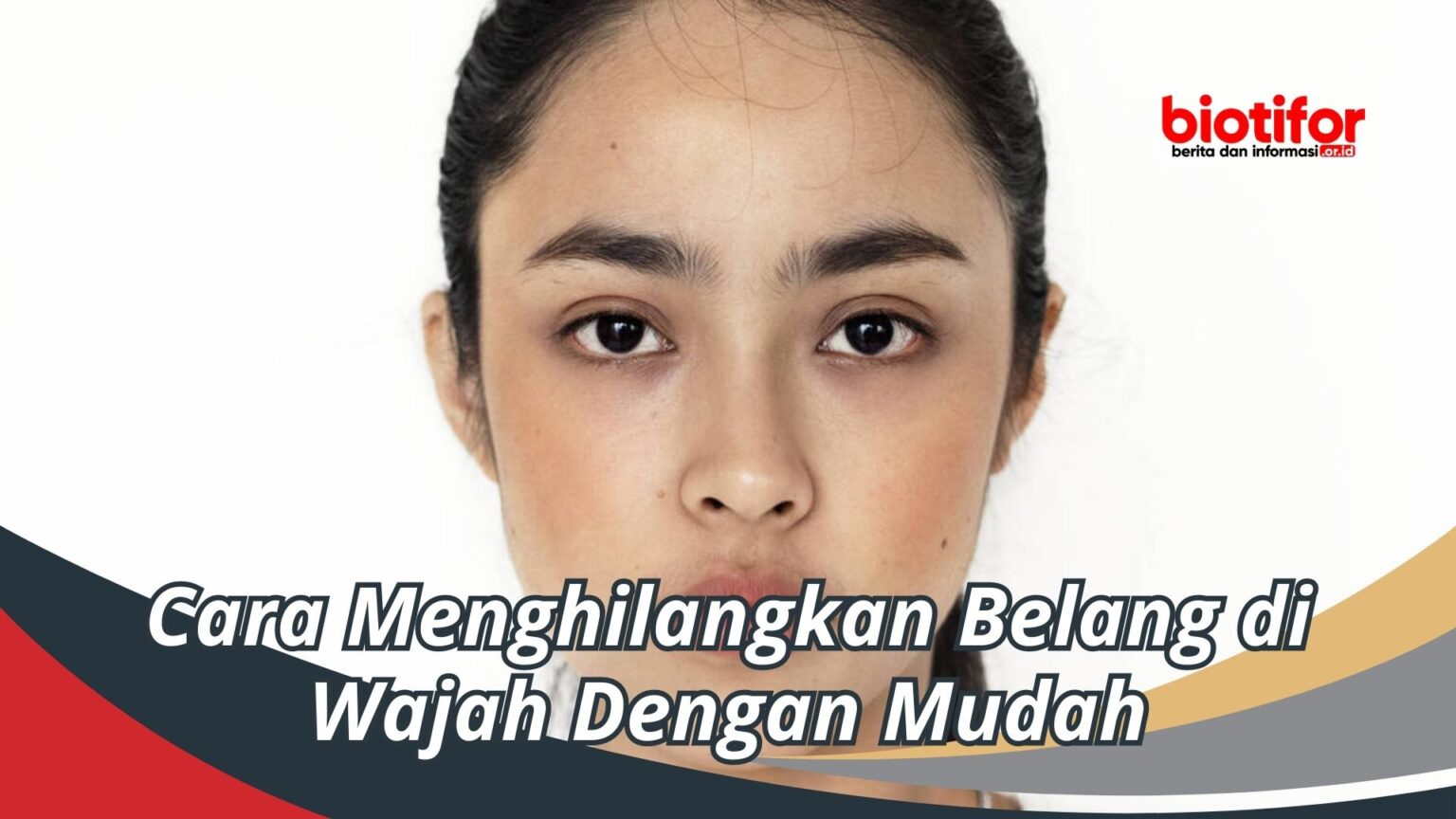 Cara Menghilangkan Belang Di Wajah Dengan Mudah Biotifor