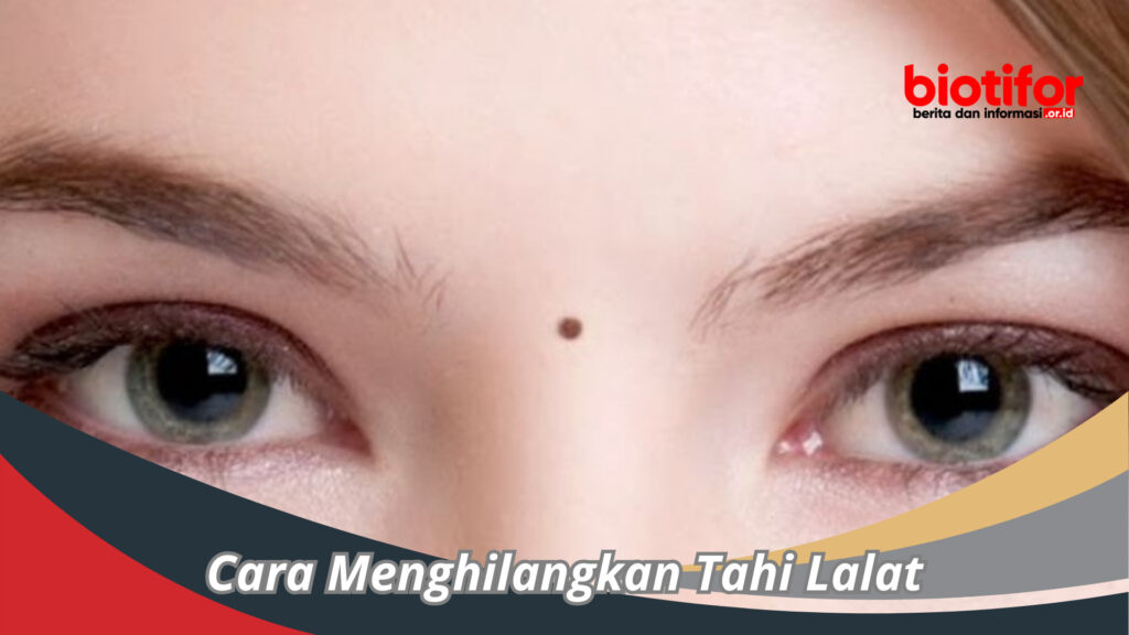 Cara Menghilangkan Tahi Lalat Dengan Langkah Alami