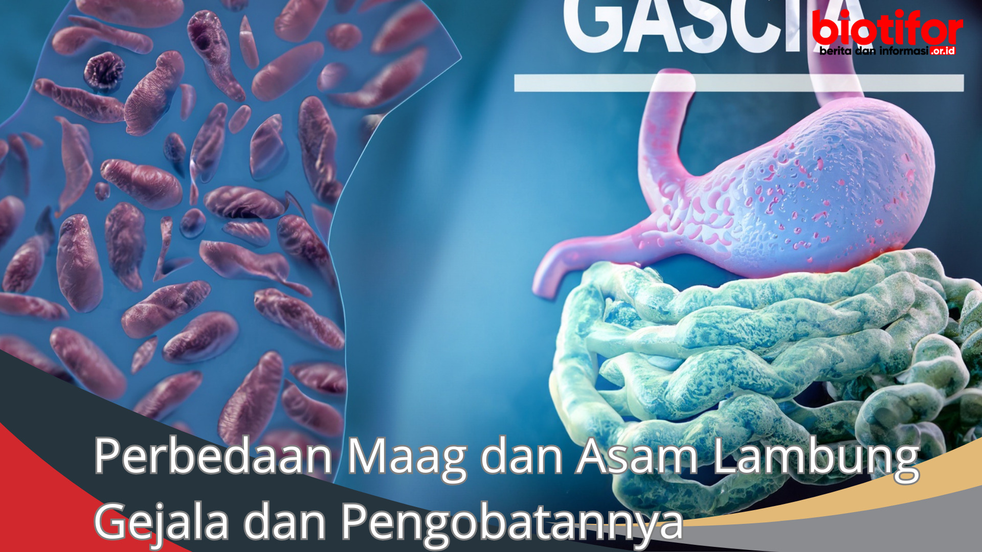 Perbedaan Maag dan Asam Lambung Gejala dan Pengobatannya