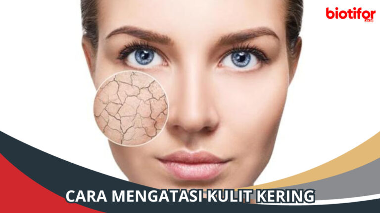 Cara Mengatasi Kulit Kering Dan Bersisik Secara Alami - Biotifor