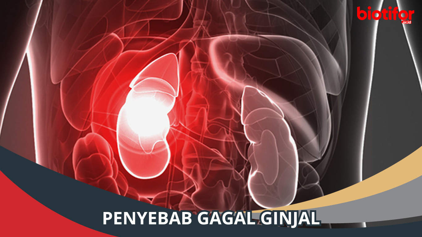 8 Penyebab Gagal Ginjal Dan Cara Mencegahnya - Biotifor