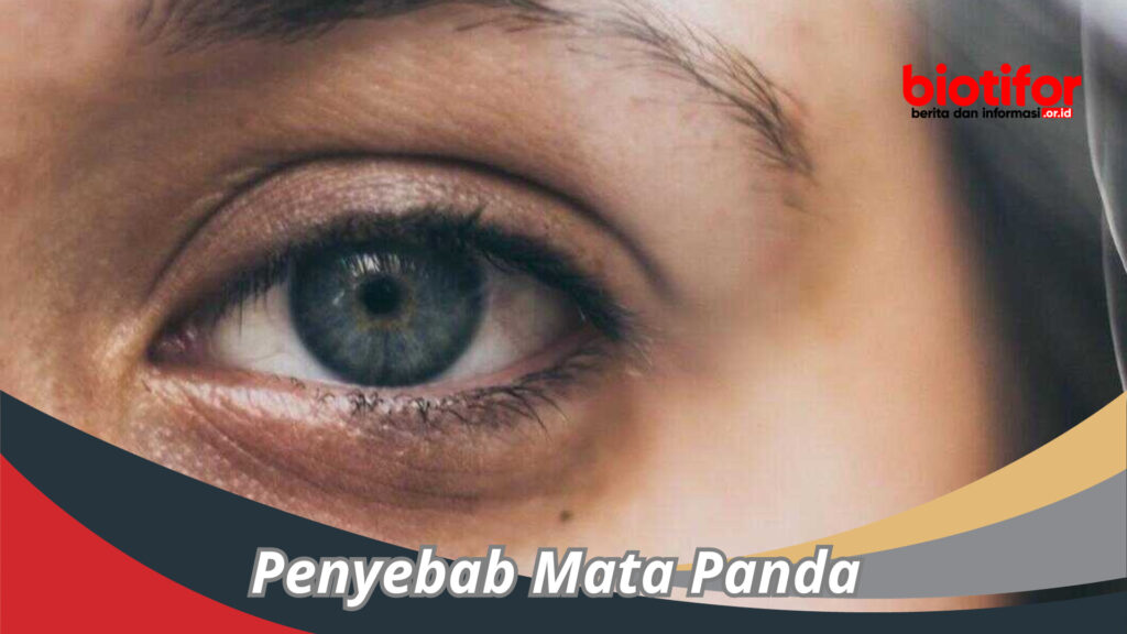 Inilah Penyebab Mata Panda Yang Jarang Diketahui - Biotifor