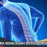 Cara Mencegah Osteoporosis