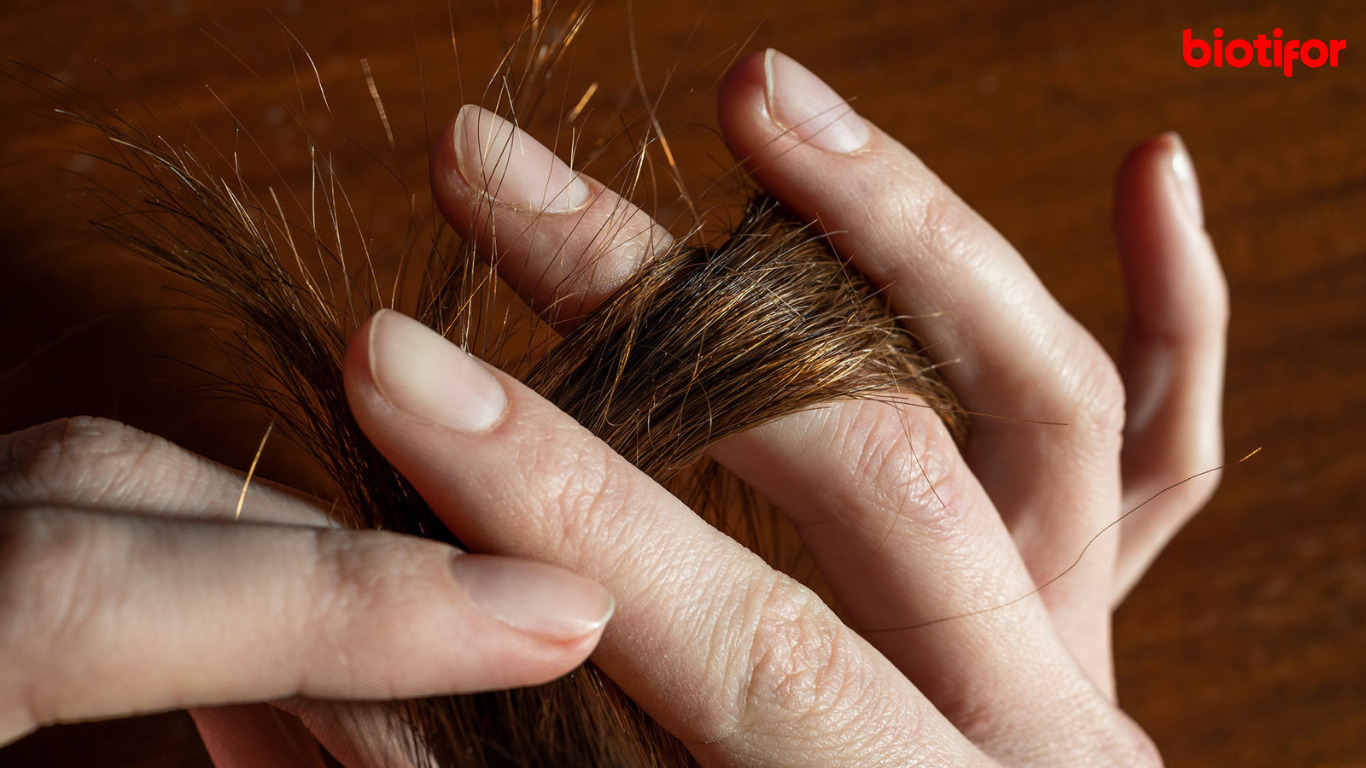 Cara Mengatasi Rambut Bercabang Panduan Lengkap Biotifor