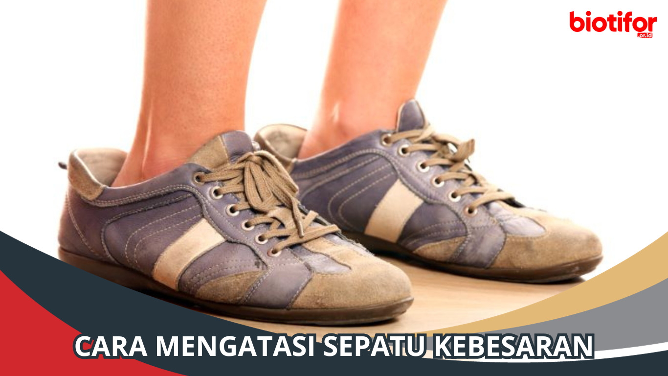 Cara Mengatasi Sepatu Kebesaran: Tips Praktis dan Nyaman