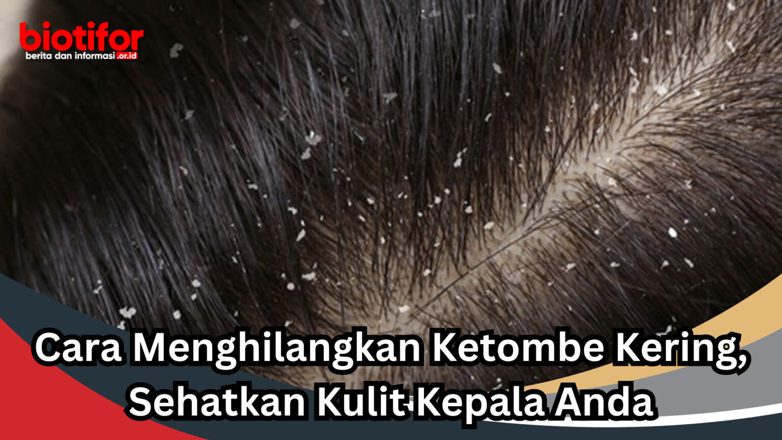 Cara Mencegah Ketombe dan Kulit Kepala Gatal: 12 Tips Efektif untuk Kulit Kepala Sehat