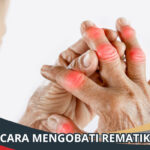 Cara Mengobati Rematik