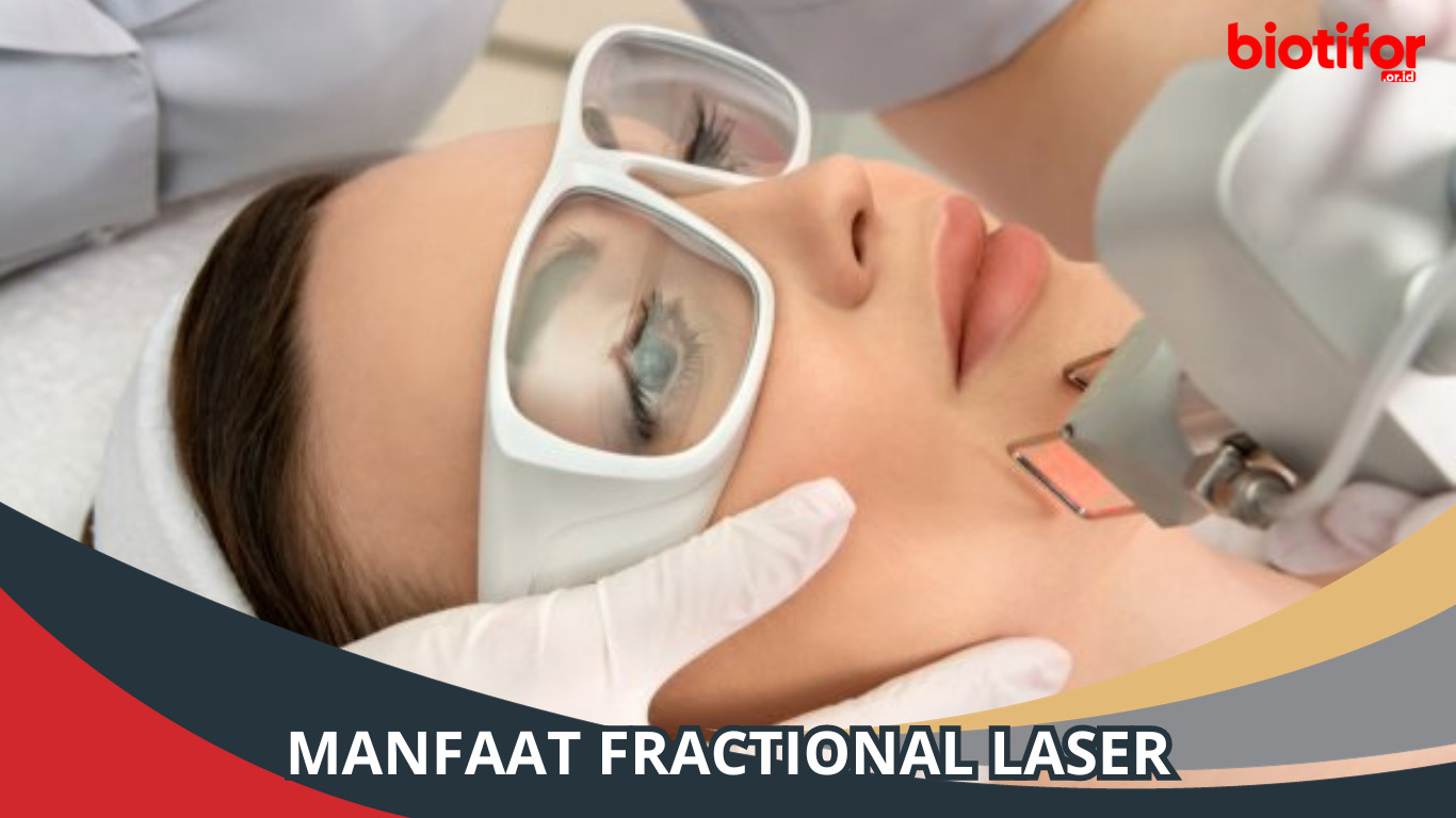 Manfaat Fractional Laser, Maksimalkan Kecantikan Kulit Anda