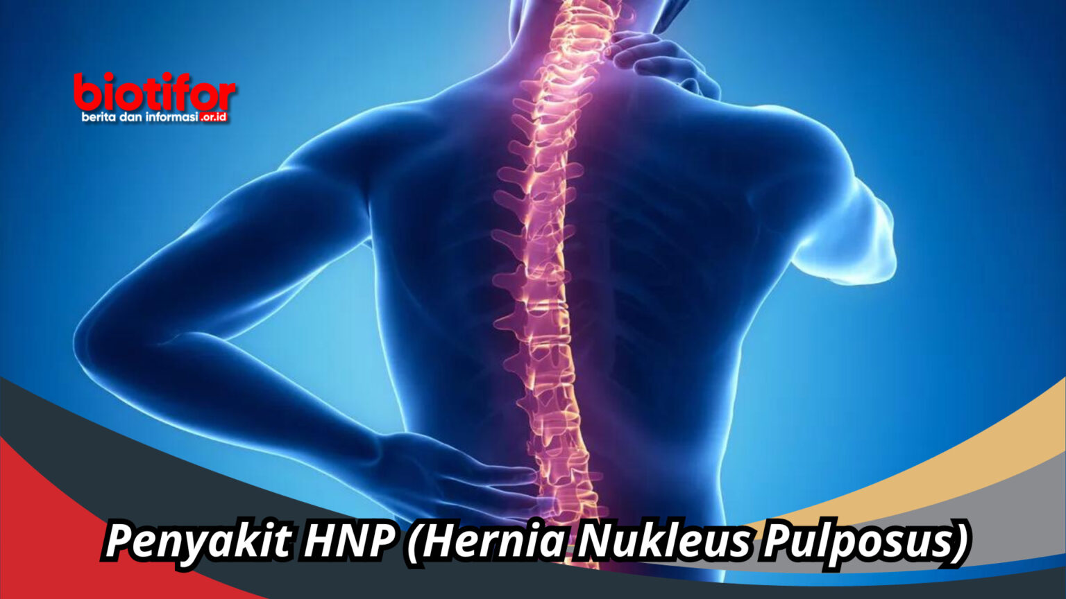 Mengenal Penyakit HNP (Hernia Nukleus Pulposus), Penyebab, Gejala ...